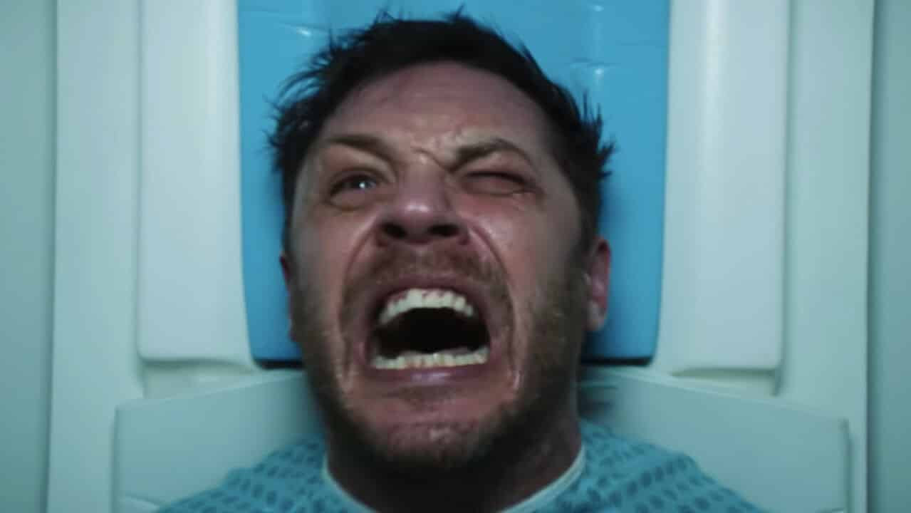 Venom: Tom Hardy ferito sul set del film di Ruben Fleischer