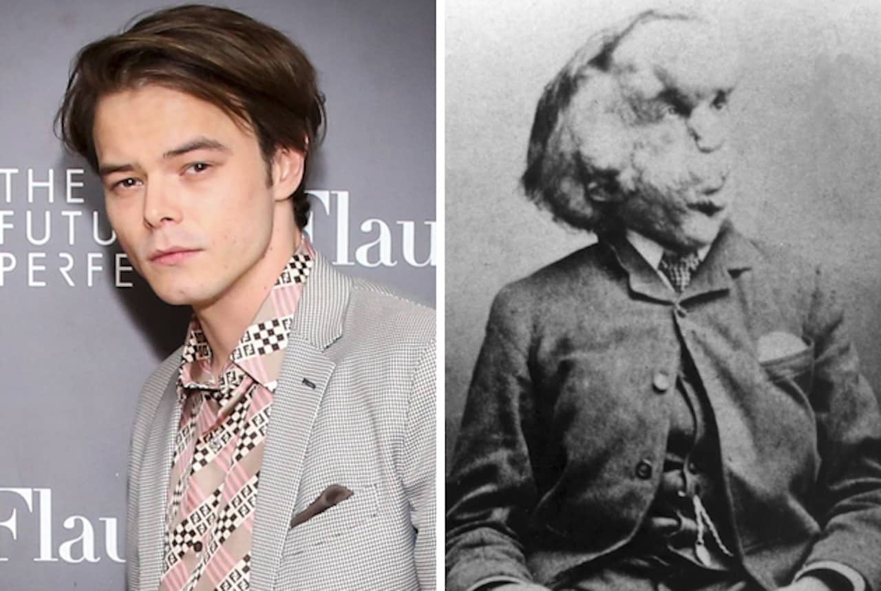 The Elephant Man: Charlie Heaton di Stranger Things nella serie di BBC