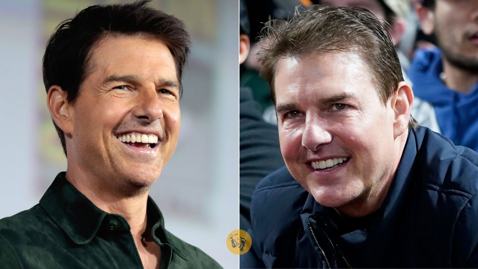 Tom Cruise “irriconoscibile” a una partita di baseball. Colpa del filler?