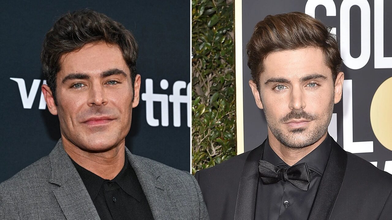 Zac Efron e i dettagli del terribile incidente domestico che gli ha deturpato il volto: “Sono quasi morto”