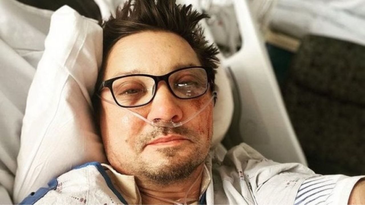 Jeremy Renner rischia l’amputazione di una gamba