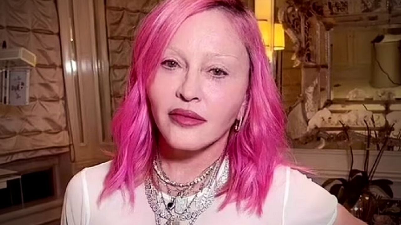 Madonna torna a mostrarsi dopo le critiche post-chirurgia estetica: “guardate quanto sono carina ora che il gonfiore è passato” [FOTO]