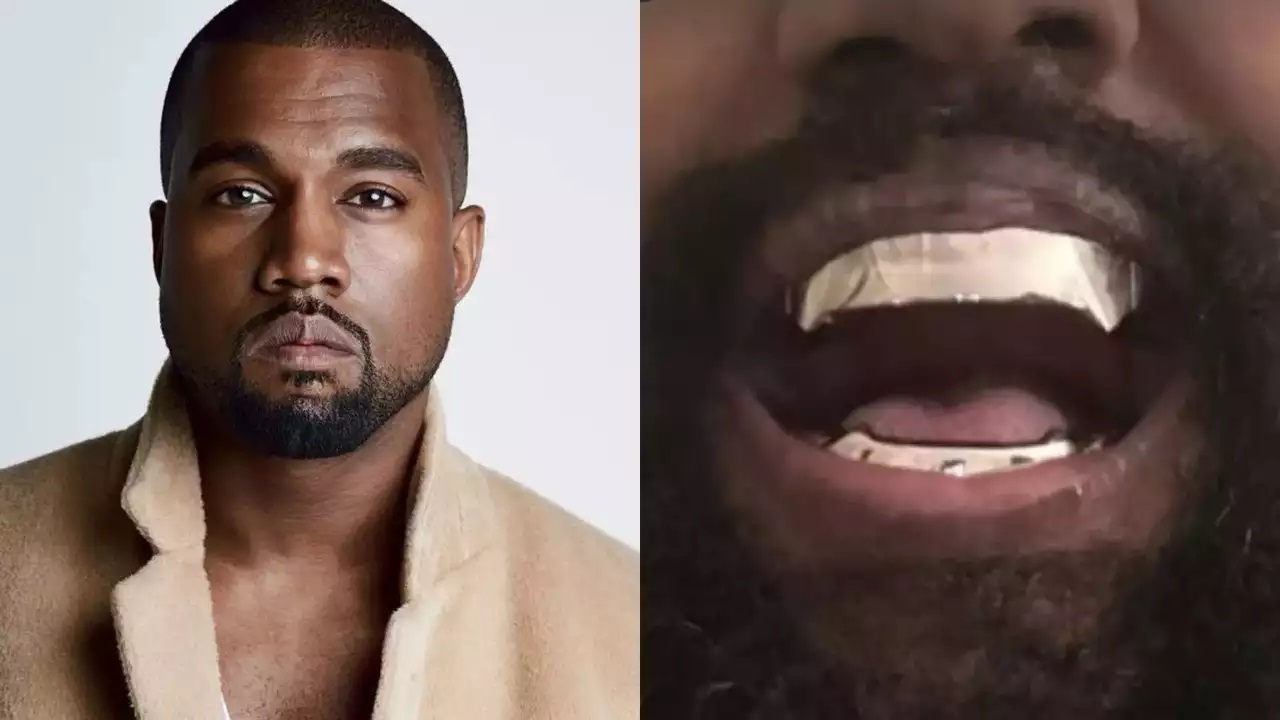 Kanye West e la costosissima protesi in titanio: il nuovo sorriso della star omaggia Jaws [FOTO]
