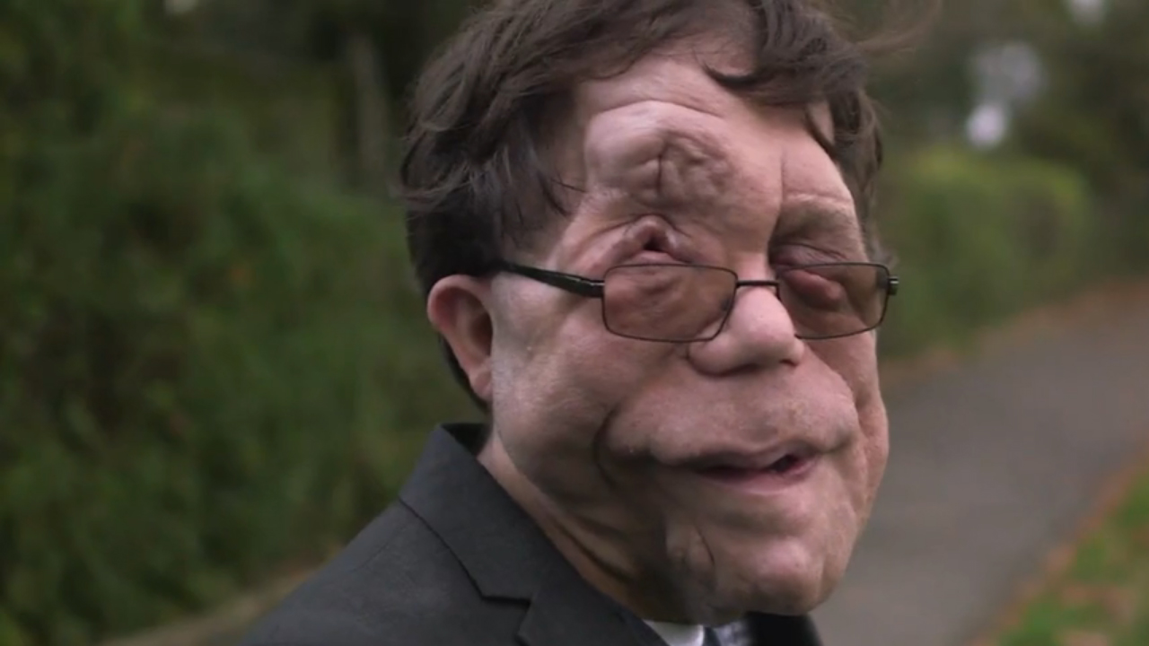 Adam Pearson - cinematographe.it
