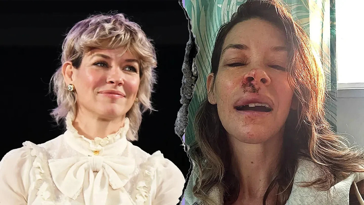 Evangeline Lilly, brutto incidente per l’attrice durante una gita al mare: il suo volto è sfigurato! [FOTO]